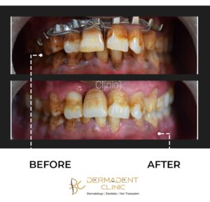 Best Hair ,Dental and Skin Treatment in Udaipur