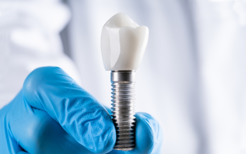 dental implants in udaipur, best dental clinic in udaipur