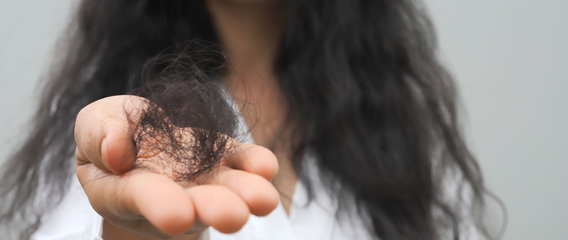 Hair Transplant & Hair Fall Treatment in Udaipur