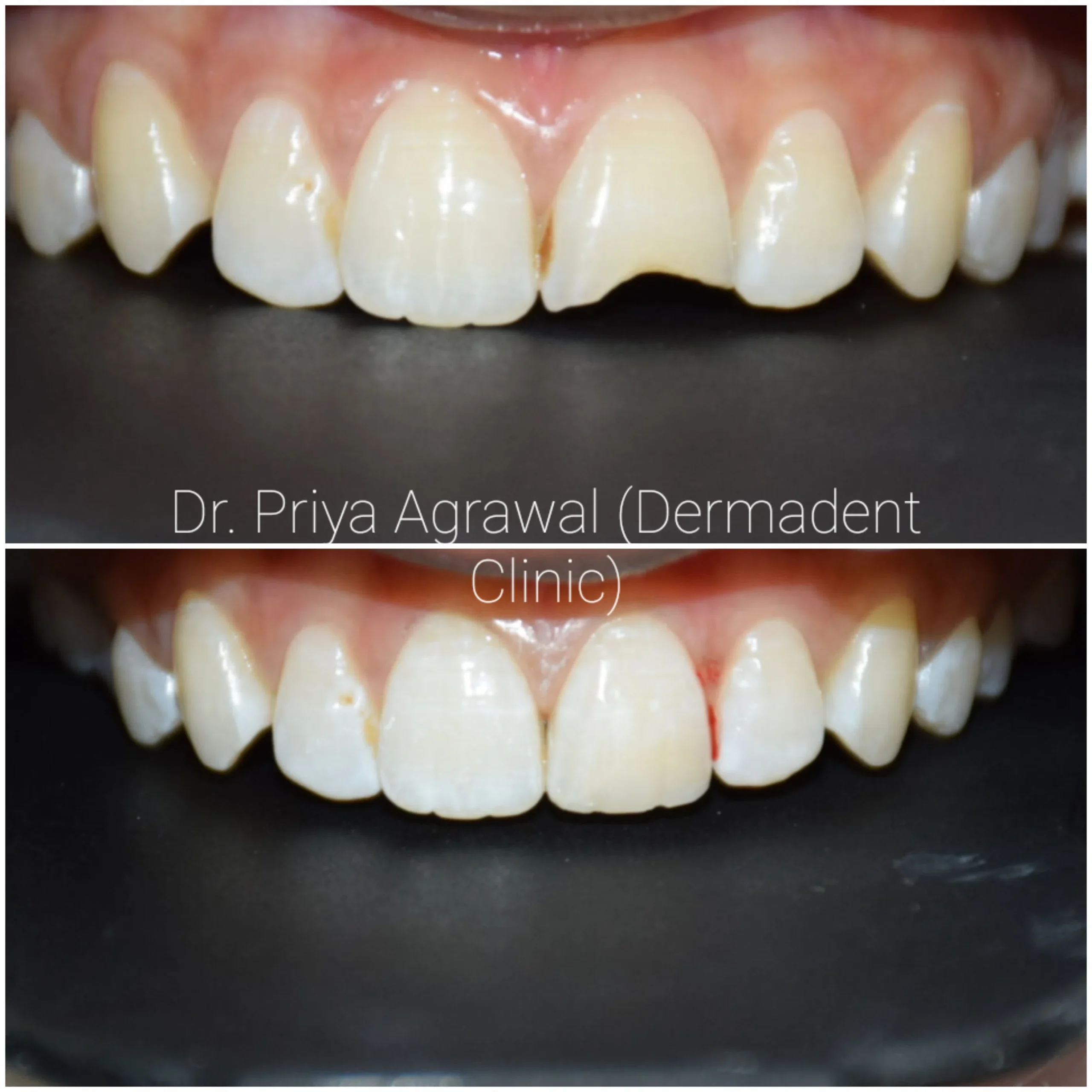 dermadent-udaipur-dental-repair