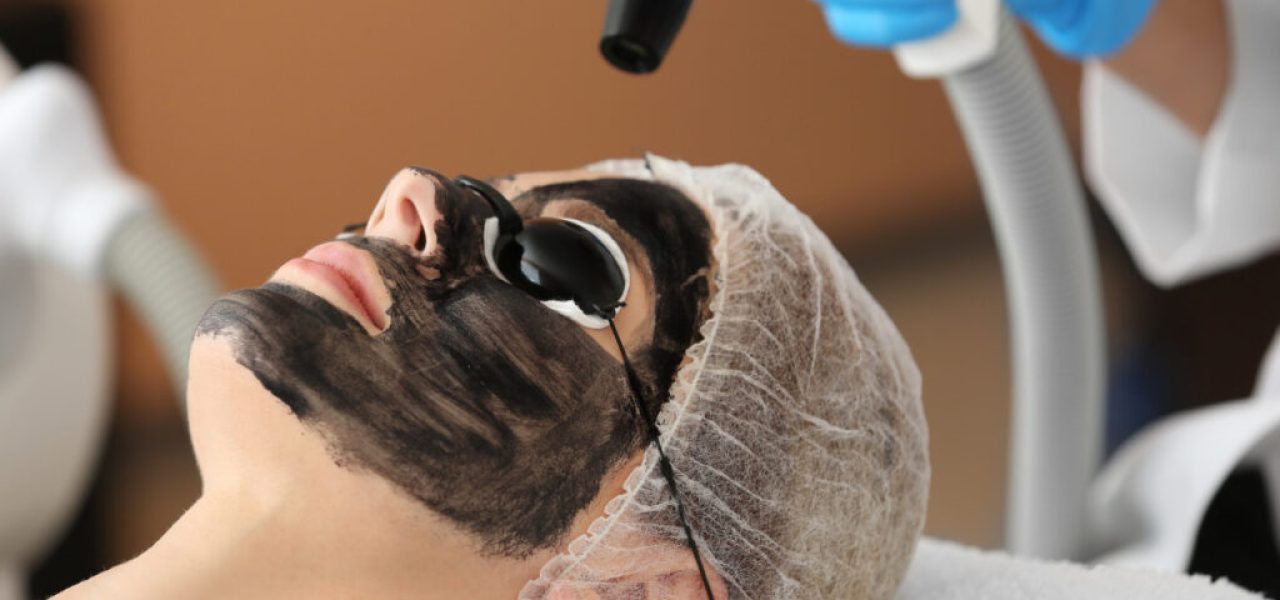 Carbon peel treatment at Dermadent Clinic